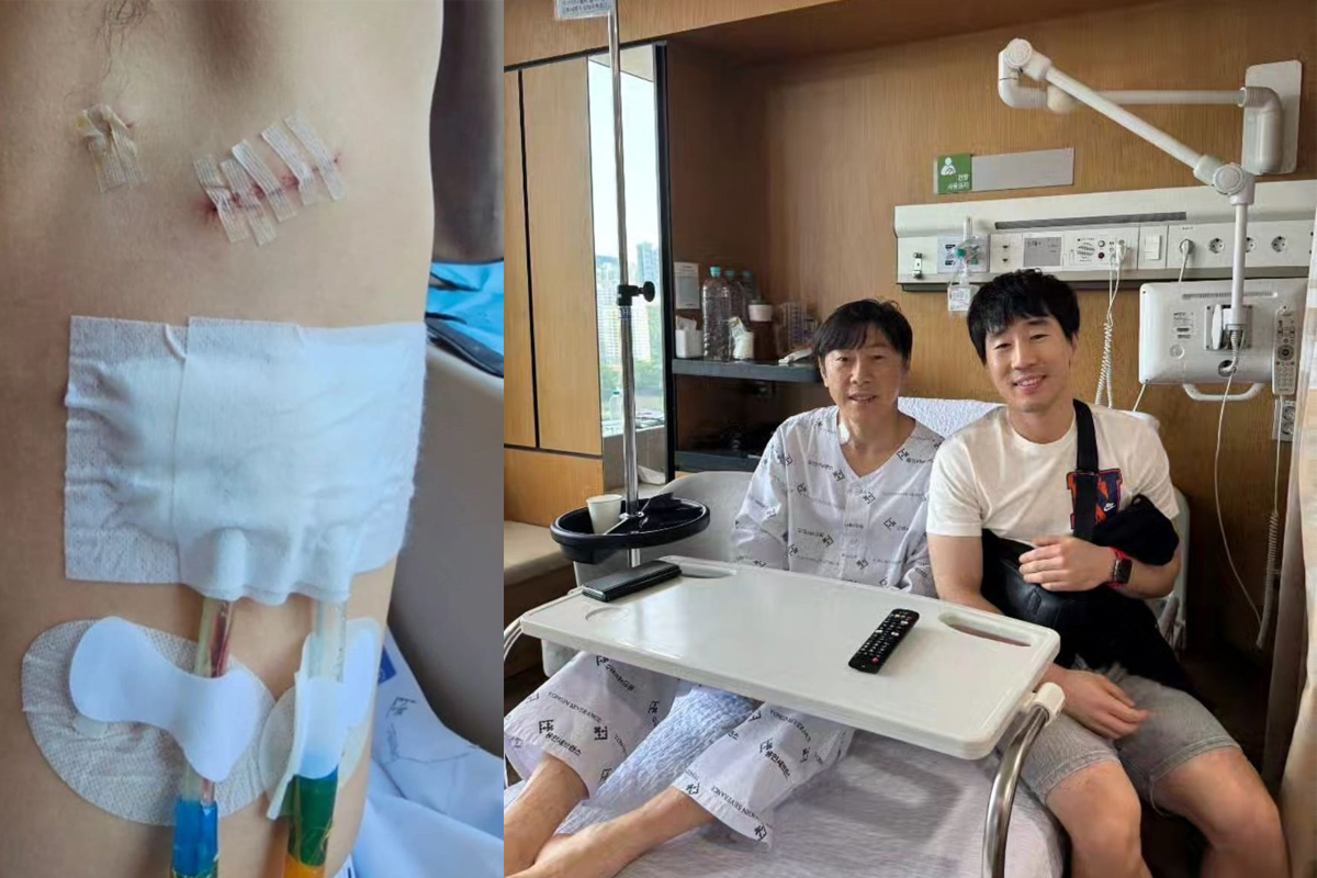 Apa Itu Pleuritis? Penyakit yang Diderita Shin Tae-yong, Harus Operasi 6 Jam, Simak Penjelasannya