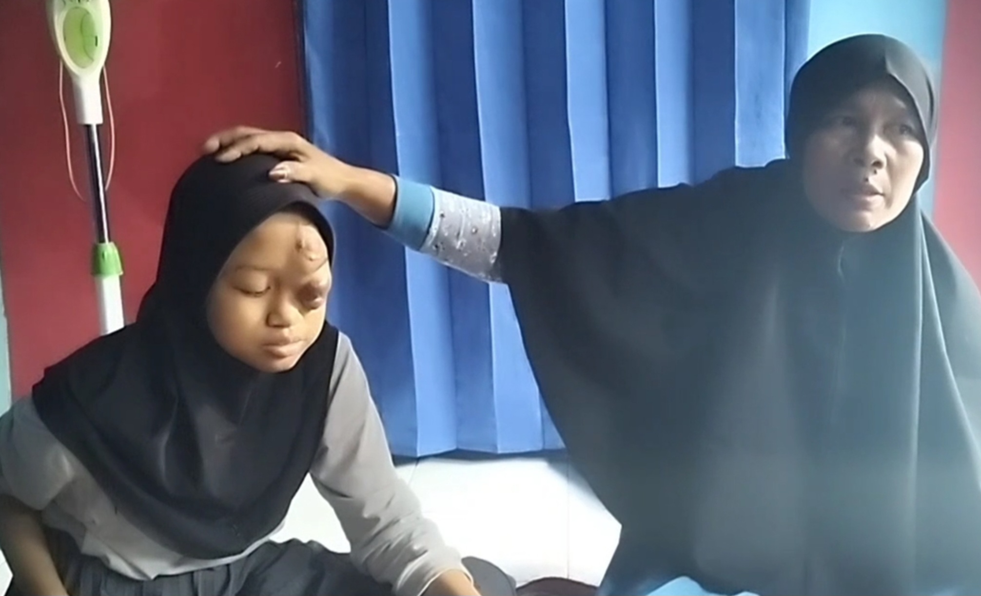 Miris, Gadis Penderita Tumor Mata di Kuningan Jadi Korban Bullying hingga Tak Mau Sekolah
