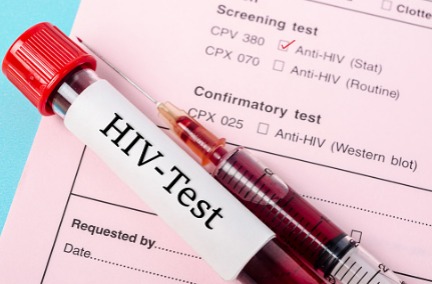Miris, Penderita HIV AIDS di Kabupaten Kuningan Bertambah 66 Orang, Didominasi dari Penyimpangan Seks