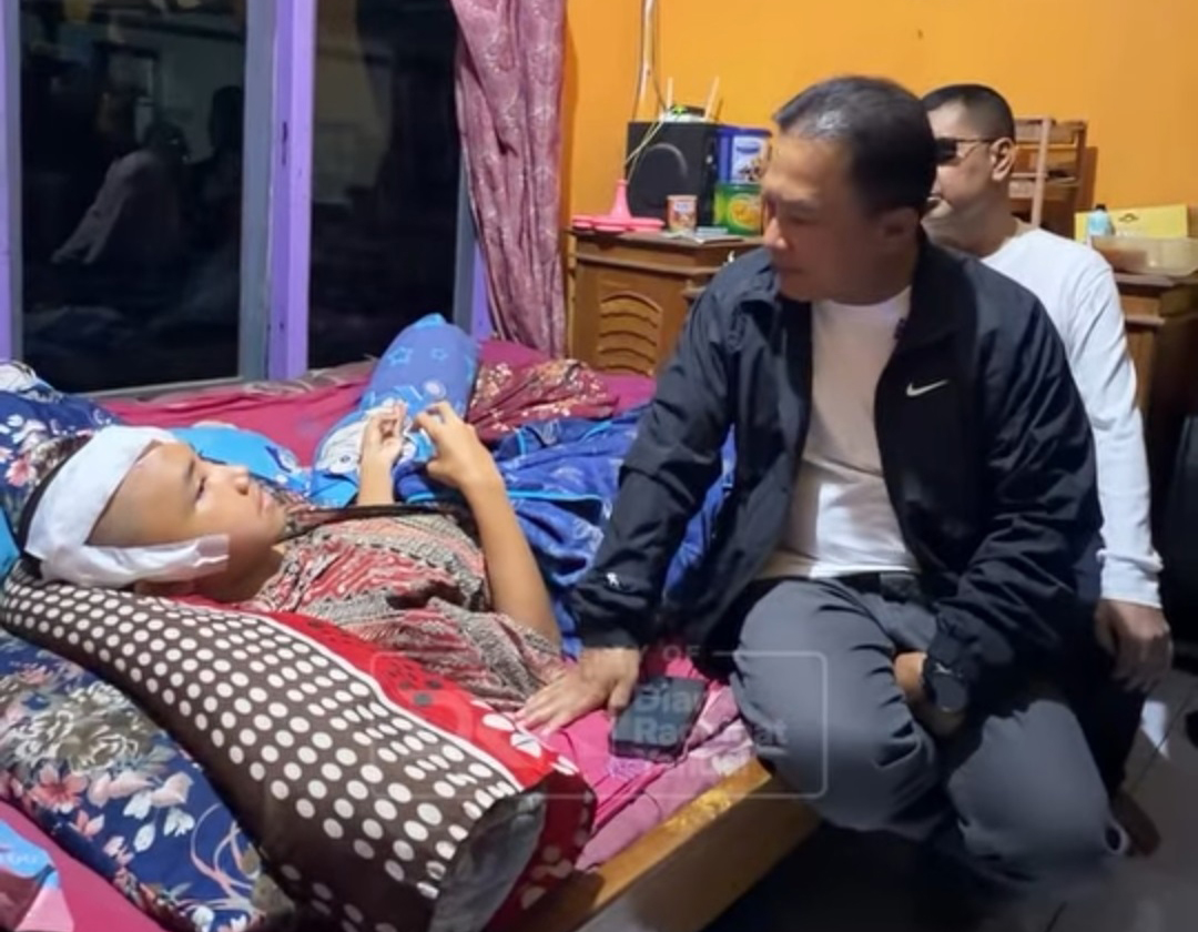 Siswa SMP Kuningan Dihajar hingga 30 Jahitan, Bupati: Ini Kriminal
