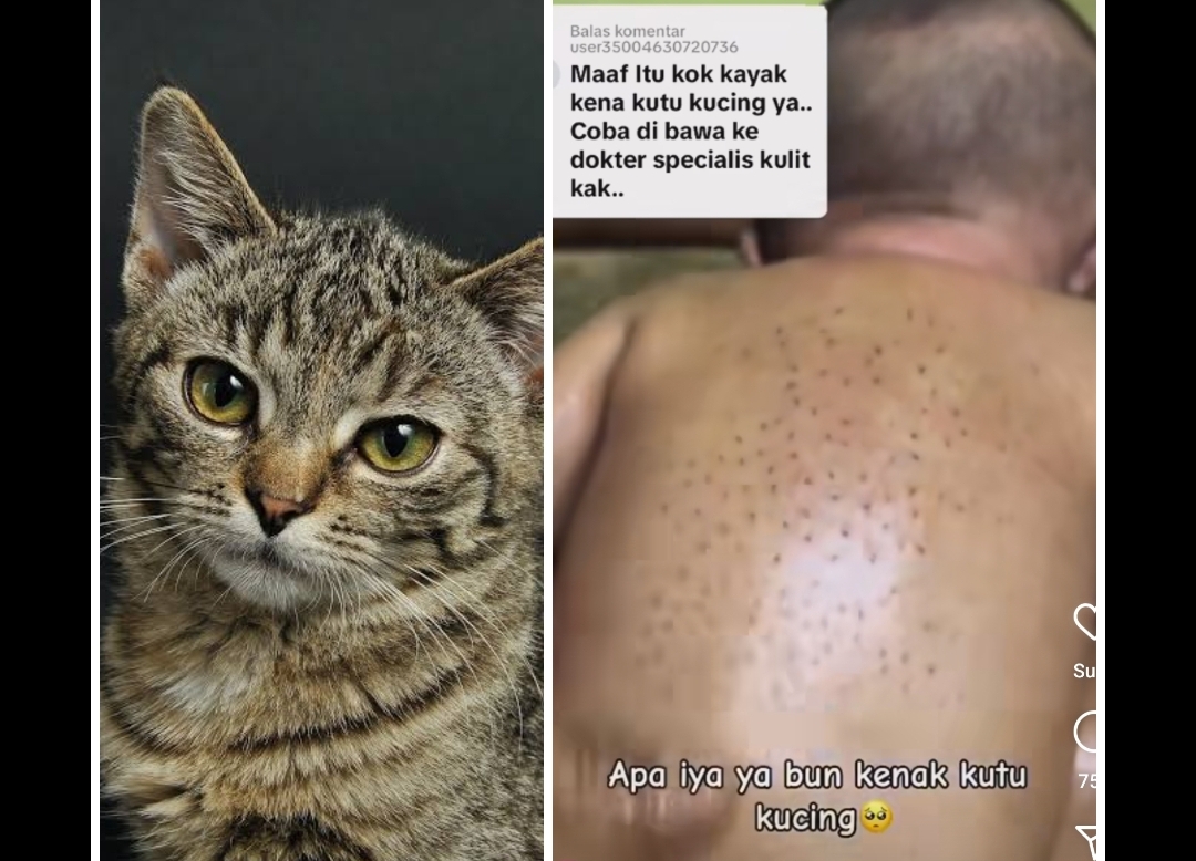 Viral Bintik Hitam di Punggung Bayi Disebut karena Kutu Kucing, Benarkah? Cek Penjelasannya