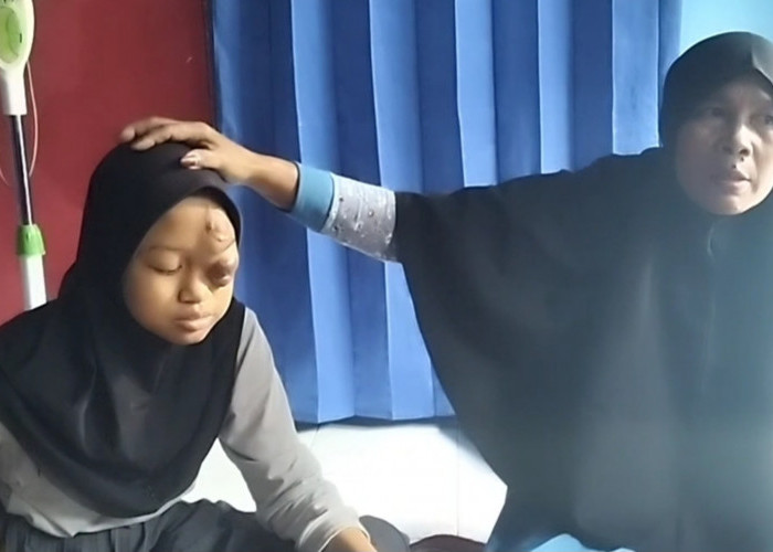 Miris, Gadis Penderita Tumor Mata di Kuningan Jadi Korban Bullying hingga Tak Mau Sekolah