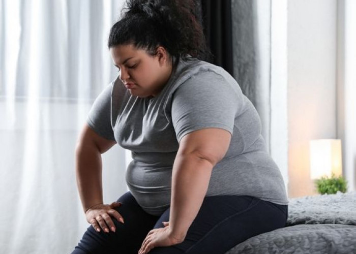 Hati-hati! Ini 6 Ciri Awal Gejala Obesitas dan Cara Mengatasinya