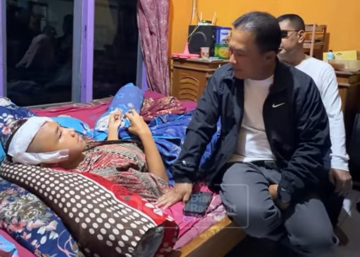 Siswa SMP Kuningan Dihajar hingga 30 Jahitan, Bupati: Ini Kriminal