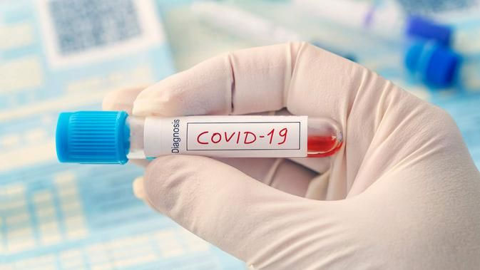 10 Pasien Covid-19 Dipulangkan, Hasil Swab Test Kedua Belum Keluar, Tetap Dalam Pemantauan